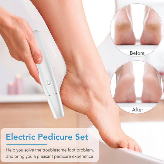 🔥Last Day Special Price £11.99!!💥🎁Portable Electric Feet Callus Remover