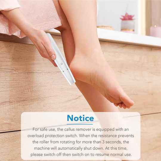 🔥Last Day Special Price £11.99!!💥🎁Portable Electric Feet Callus Remover