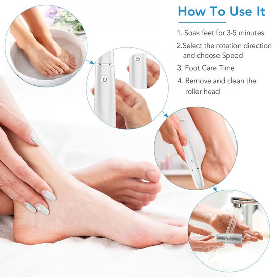 🔥Last Day Special Price £11.99!!💥🎁Portable Electric Feet Callus Remover