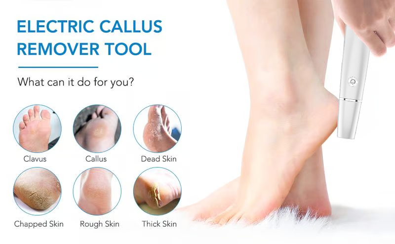 🔥Last Day Special Price £11.99!!💥🎁Portable Electric Feet Callus Remover