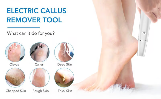 🔥Last Day Special Price £11.99!!💥🎁Portable Electric Feet Callus Remover