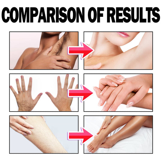 ✨ODALIT™ Say Goodbye to Body Hair