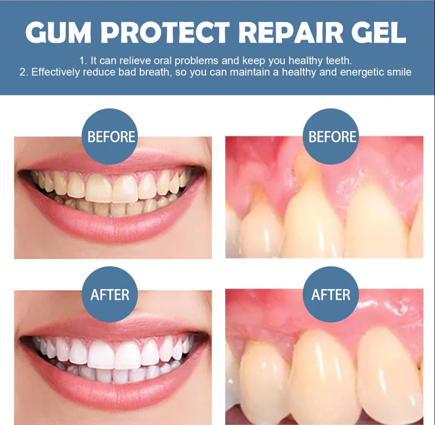 Gum Protect Dental Repair Gel【3 tubes/box】