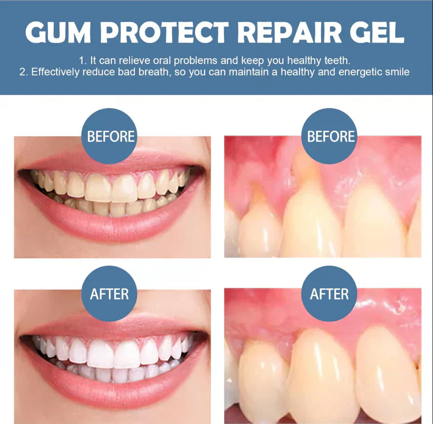 🏆 Last Day Special Price £8.99 ! 🦷Buy 2 Get 1 Free🎁 Teeth Whitening & Repair Gel