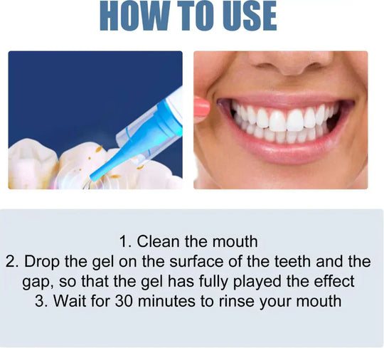 🏆 Last Day Special Price £8.99 ! 🦷Buy 2 Get 1 Free🎁 Teeth Whitening & Repair Gel