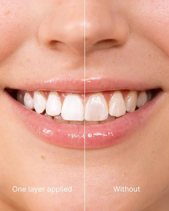 Tooth Polish - Instant Clean Smile