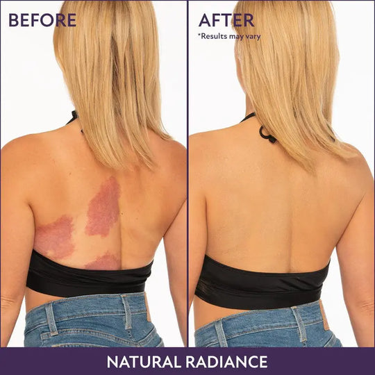 💞LAST DAY SALE 30% OFF💜✨Body Coverage Perfector – Waterproof, Lightweight & Flawless Body Makeup