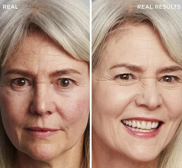 🔥50K+ SOLD! 🎁4-in-1 Perfecting Foundation – High Coverage, SPF & All-Day Hydration 🤍✨