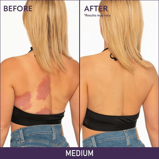 🔥HOT SALE OFF!!🔥Soft Matte Cream Concealer