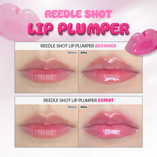 💗 Reedle Shot Lip Plumperr - K-Beauty Tech ✨