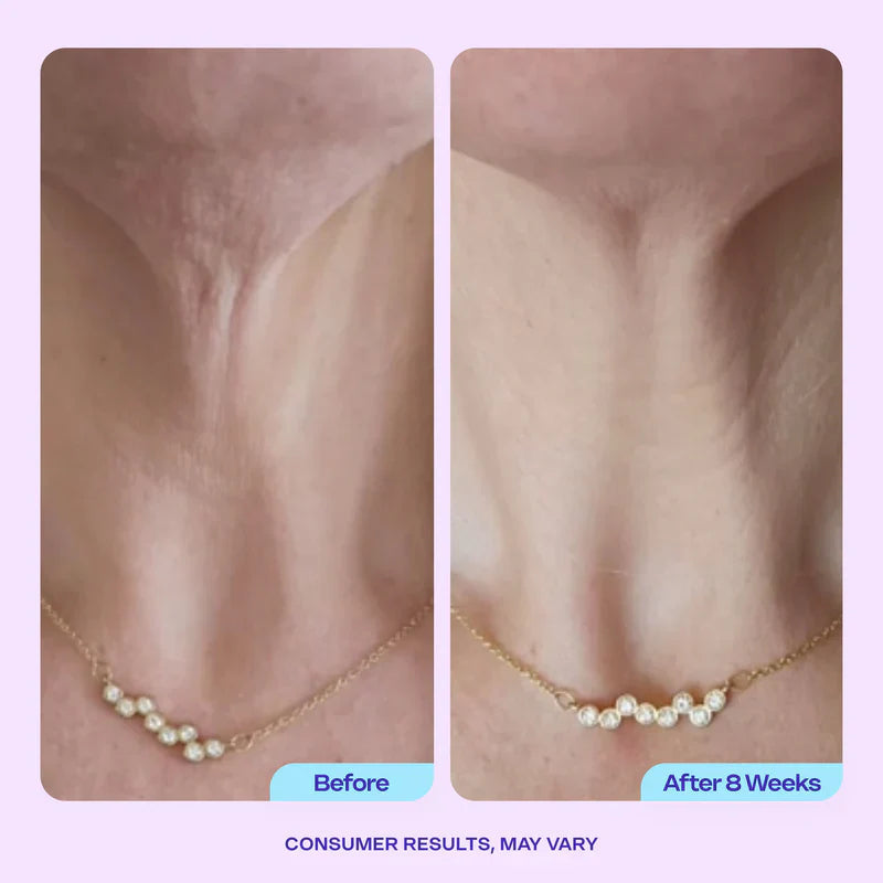 Advanced Firming Neck Cream – Visibly Lifts & Tightens "Turkey0