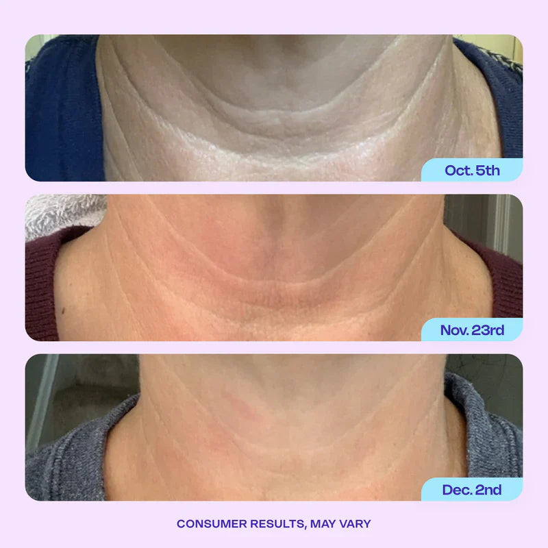 Advanced Firming Neck Cream – Visibly Lifts & Tightens "Turkey0