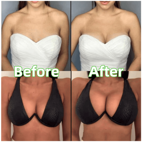 💕Best Seller-60% OFF💜Lift Inserts for Bras – Lightly Padded, Double-Sided Adhesive👙 Reusable, Washable • Natural Lift • Seamless Under Clothing ✨