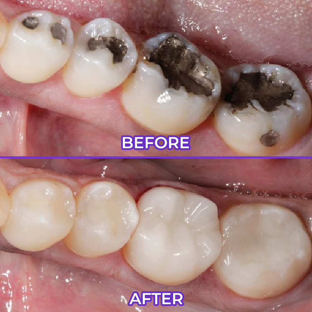 Biancat® SensiGum Fluoride Toothpaste