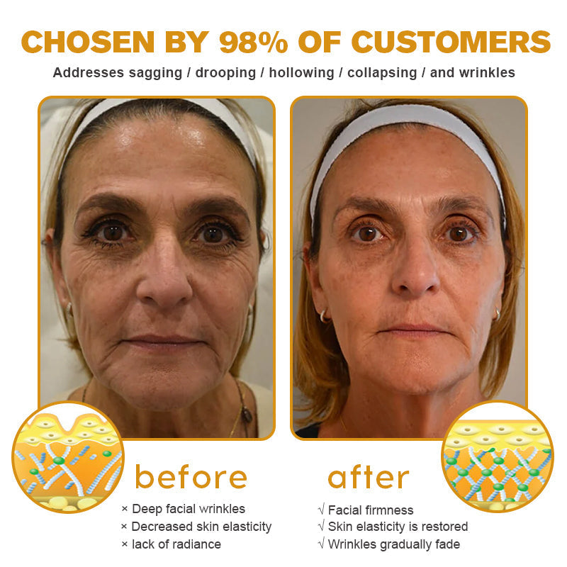 (Made and Shipped from USA) 🧑‍⚕️TLOPA® Botox Bee Venom Wrinkle Removal Cream- LAST DAY 70% OFF🔥