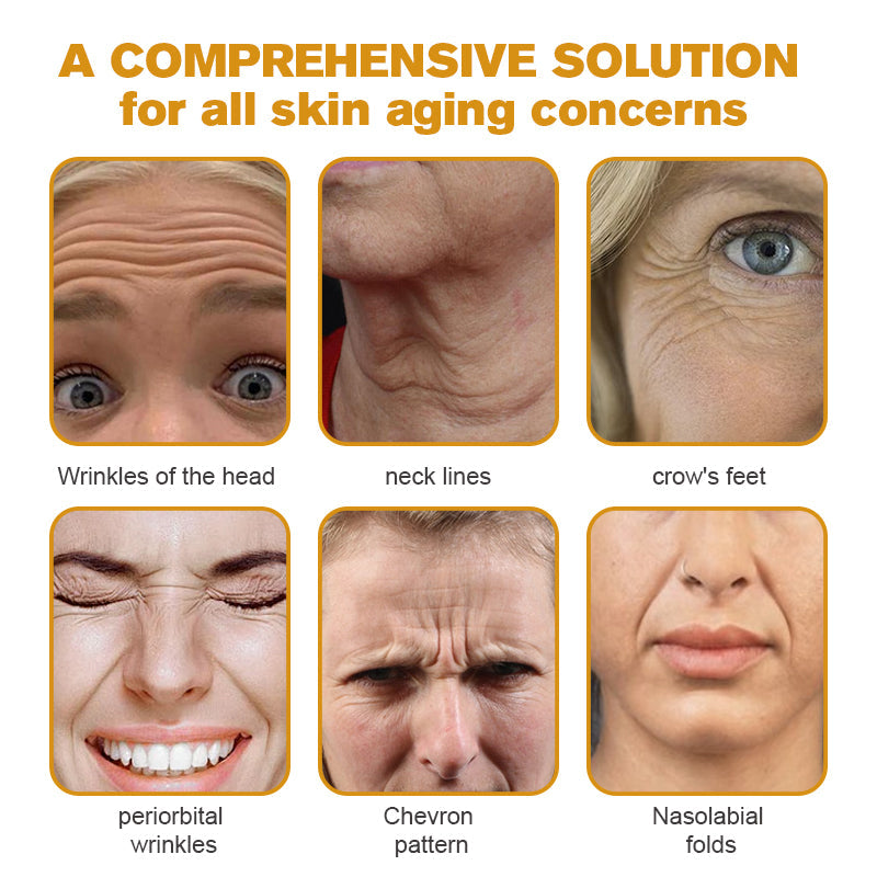 (Made and Shipped from USA) 🧑‍⚕️TLOPA® Botox Bee Venom Wrinkle Removal Cream- LAST DAY 70% OFF🔥