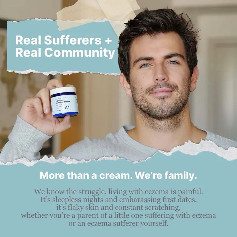 Crema calmante natural con musgo mariño & Avea - Eczema & Alivio da psoríase - Ocean Minerals - para pel sensible - Crema hidratante para eccemas para pel seca