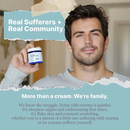 Crema calmante natural con musgo mariño & Avea - Eczema & Alivio da psoríase - Ocean Minerals - para pel sensible - Crema hidratante para eccemas para pel seca