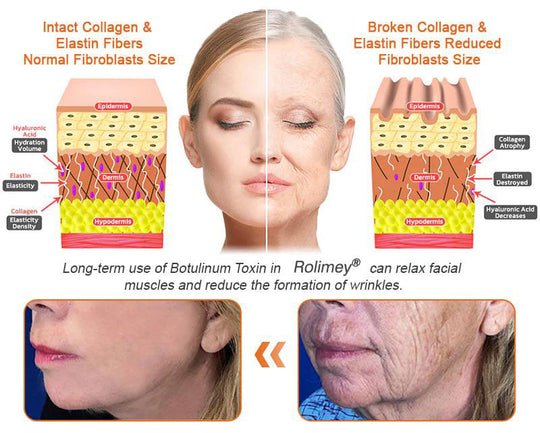 🧑‍⚕️𝑶𝒇𝒇𝒊𝒄𝒊𝒂𝒍 𝑺𝒕𝒐𝒓𝒆 | 𝐑𝐨𝐥𝐢𝐦𝐞𝐲® 𝐁𝐨𝐭𝐨𝐱 𝐁𝐞𝐞 𝐕𝐞𝐧𝐨𝐦 𝐅𝐢𝐫𝐦𝐢𝐧𝐠 𝐒𝐞𝐫𝐮𝐦 𝐒𝐭𝐢𝐜𝐤 - 𝐓𝐚𝐫𝐠𝐞𝐭𝐬 𝐒𝐚𝐠𝐠𝐢𝐧𝐠 𝐒𝐤𝐢𝐧 & 𝐖𝐫𝐢𝐧𝐤𝐥𝐞𝐬 𝐀𝐥𝐥 𝐎𝐯𝐞𝐫 𝐁𝐨𝐝𝐲 𝐰𝐢𝐭𝐡 𝐀𝐝𝐯𝐚𝐧𝐜𝐞𝐝 𝐏𝐞𝐩𝐭𝐢𝐝𝐞 𝐓𝐞𝐜𝐡𝐧𝐨𝐥𝐨𝐠𝐲, 𝐕𝐢𝐬𝐢𝐛𝐥𝐞 𝐑𝐞𝐬𝐮𝐥𝐭𝐬 𝐢𝐧 𝟑 𝐃𝐚𝐲𝐬 (⏳𝐋𝐀𝐒𝐓 𝐃𝐀𝐘 3𝟎% 𝐎𝐅𝐅)