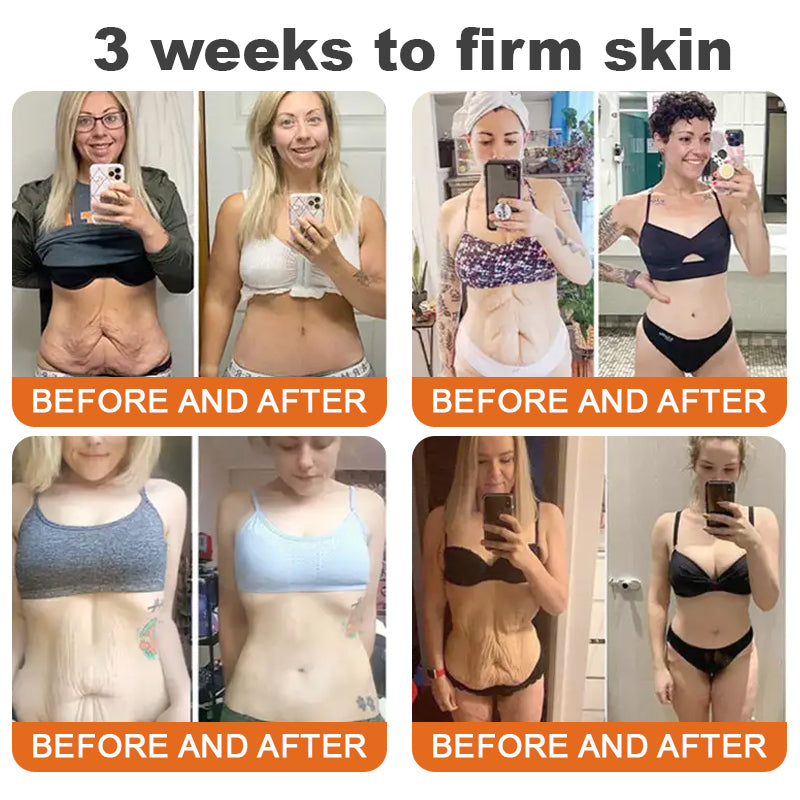 🧑‍⚕️𝑶𝒇𝒇𝒊𝒄𝒊𝒂𝒍 𝑺𝒕𝒐𝒓𝒆 | 𝐑𝐨𝐥𝐢𝐦𝐞𝐲® 𝐁𝐨𝐭𝐨𝐱 𝐁𝐞𝐞 𝐕𝐞𝐧𝐨𝐦 𝐅𝐢𝐫𝐦𝐢𝐧𝐠 𝐒𝐞𝐫𝐮𝐦 𝐒𝐭𝐢𝐜𝐤 - 𝐓𝐚𝐫𝐠𝐞𝐭𝐬 𝐒𝐚𝐠𝐠𝐢𝐧𝐠 𝐒𝐤𝐢𝐧 & 𝐖𝐫𝐢𝐧𝐤𝐥𝐞𝐬 𝐀𝐥𝐥 𝐎𝐯𝐞𝐫 𝐁𝐨𝐝𝐲 𝐰𝐢𝐭𝐡 𝐀𝐝𝐯𝐚𝐧𝐜𝐞𝐝 𝐏𝐞𝐩𝐭𝐢𝐝𝐞 𝐓𝐞𝐜𝐡𝐧𝐨𝐥𝐨𝐠𝐲, 𝐕𝐢𝐬𝐢𝐛𝐥𝐞 𝐑𝐞𝐬𝐮𝐥𝐭𝐬 𝐢𝐧 𝟑 𝐃𝐚𝐲𝐬 (⏳𝐋𝐀𝐒𝐓 𝐃𝐀𝐘 3𝟎% 𝐎𝐅𝐅)