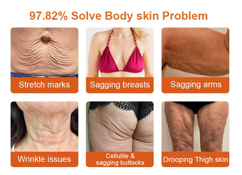 🧑‍⚕️𝑶𝒇𝒇𝒊𝒄𝒊𝒂𝒍 𝑺𝒕𝒐𝒓𝒆 | 𝐑𝐨𝐥𝐢𝐦𝐞𝐲® 𝐁𝐨𝐭𝐨𝐱 𝐁𝐞𝐞 𝐕𝐞𝐧𝐨𝐦 𝐅𝐢𝐫𝐦𝐢𝐧𝐠 𝐒𝐞𝐫𝐮𝐦 𝐒𝐭𝐢𝐜𝐤 - 𝐓𝐚𝐫𝐠𝐞𝐭𝐬 𝐒𝐚𝐠𝐠𝐢𝐧𝐠 𝐒𝐤𝐢𝐧 & 𝐖𝐫𝐢𝐧𝐤𝐥𝐞𝐬 𝐀𝐥𝐥 𝐎𝐯𝐞𝐫 𝐁𝐨𝐝𝐲 𝐰𝐢𝐭𝐡 𝐀𝐝𝐯𝐚𝐧𝐜𝐞𝐝 𝐏𝐞𝐩𝐭𝐢𝐝𝐞 𝐓𝐞𝐜𝐡𝐧𝐨𝐥𝐨𝐠𝐲, 𝐕𝐢𝐬𝐢𝐛𝐥𝐞 𝐑𝐞𝐬𝐮𝐥𝐭𝐬 𝐢𝐧 𝟑 𝐃𝐚𝐲𝐬 (⏳𝐋𝐀𝐒𝐓 𝐃𝐀𝐘 3𝟎% 𝐎𝐅𝐅)