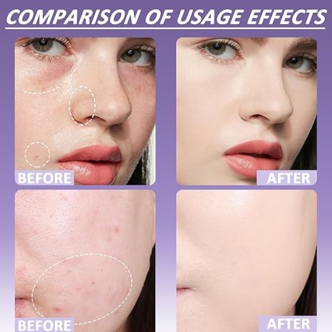 🔥HOT SALE OFF!!🔥Soft Matte Cream Concealer