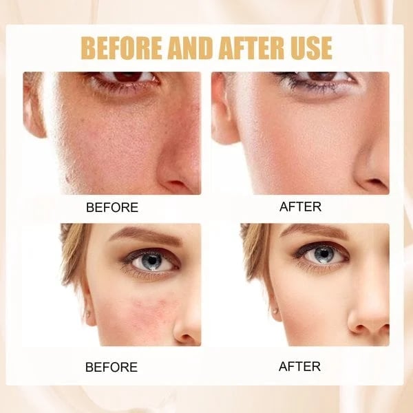 🎁 KÖP 1 FÅ 1 GRATIS! ✨ Färgförändrande foundation för mogen hud - Felfri täckning, naturligt utseende & Långvarig återfuktning 💧💄