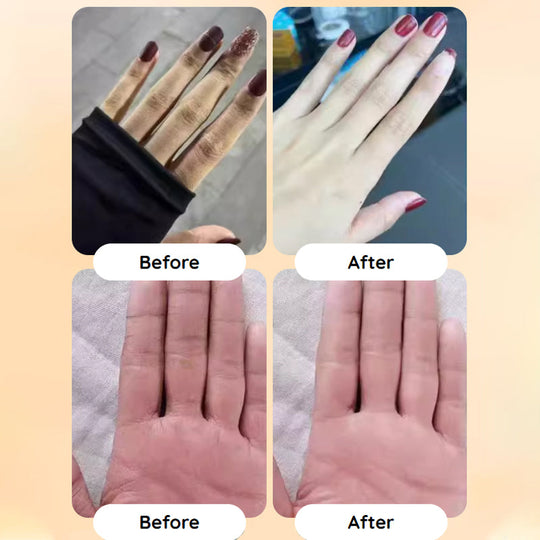 🥳2026 HOT SALE🥳💞50K+ SOLD!💧 🌸50% OFF Fresh Hydrating Hand Cream – Instant relief for dry hands! Deep moisture that lasts, leaving skin soft & supple all day. 🌿🤲
