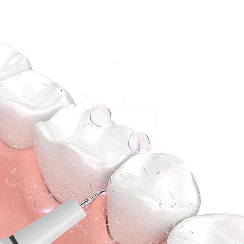 Electric ultrasonic oral irrigator