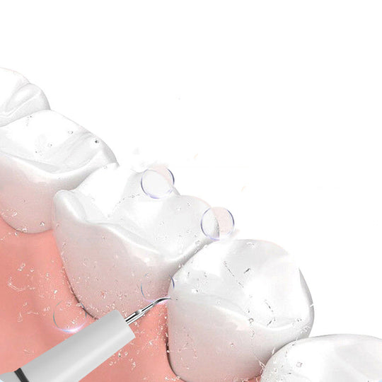 Electric ultrasonic oral irrigator