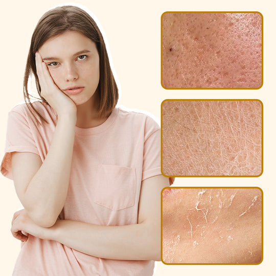 Ekologisk nötkötttalgbalsam med honung – fuktgivande kräm