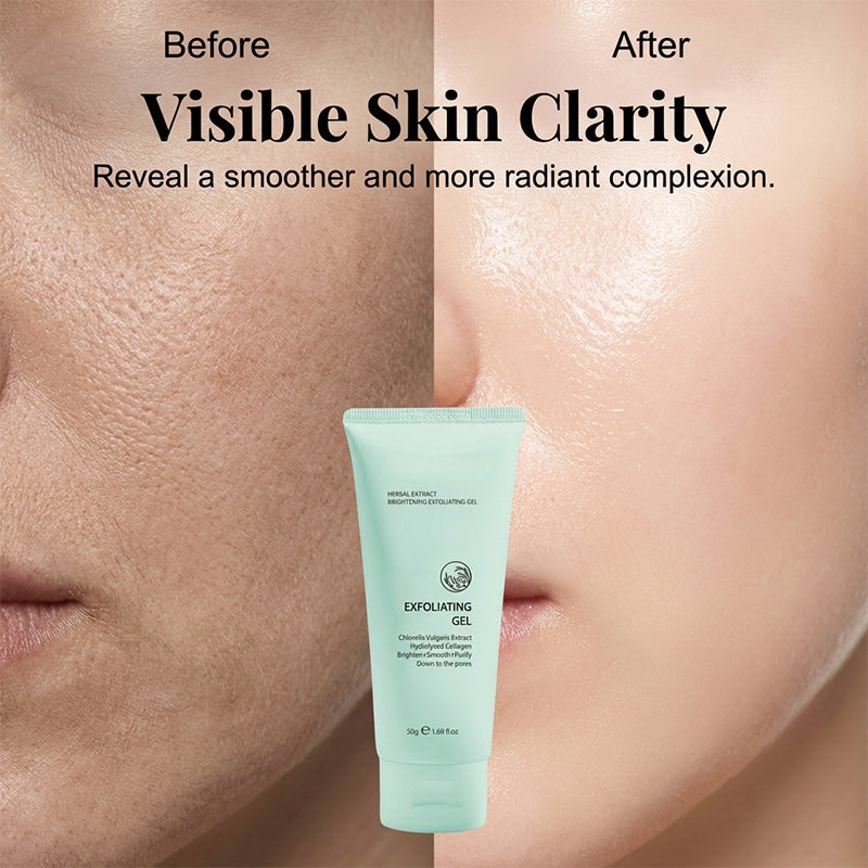 🥳2026 HOT SALE🥳💞50K+ SOLD!💥👵🌸 50% OFF! Herbal Brightening Exfoliating Gel – Gently lifts dead skin, unclogs pores. Aloe vera soothes & hydrates. Reveals smoother, radiant skin. 🧴✨