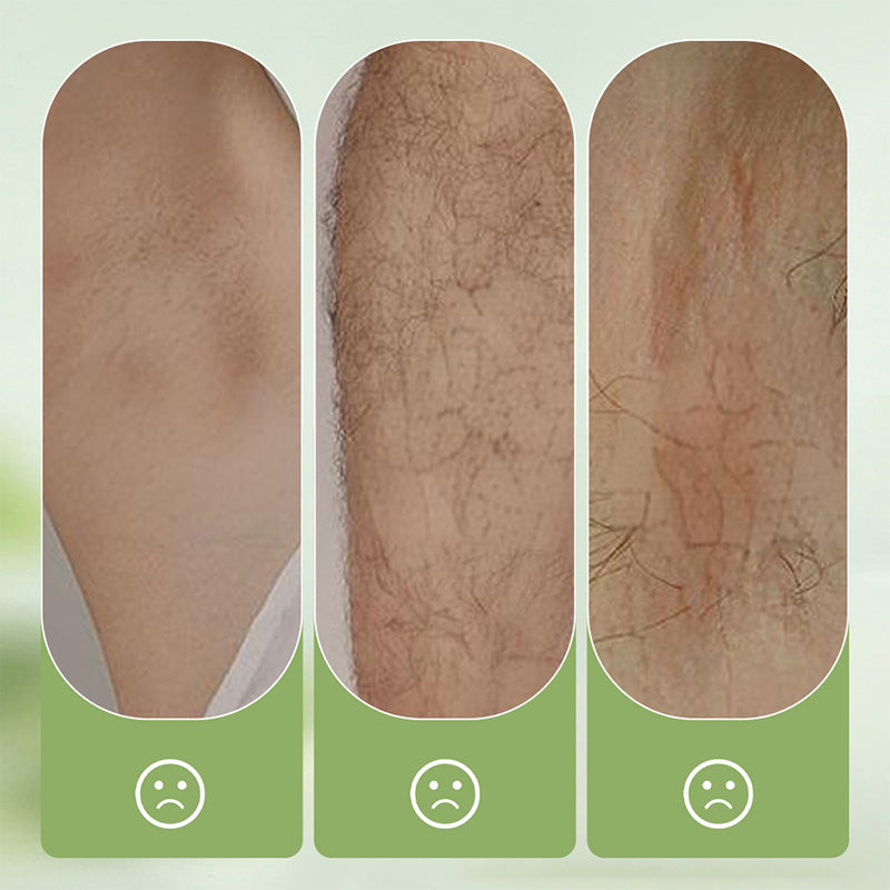 🎁Gentle and Non-Irritating Hair Removal Cream