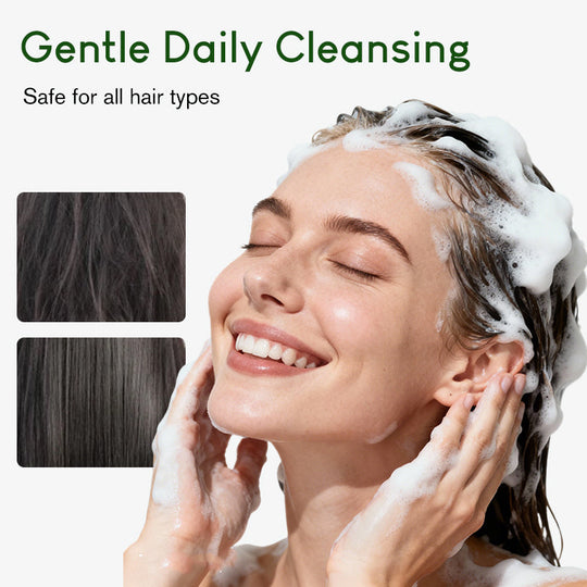 🧴✨Natural Hair Growth Shampoo Anti Hair Loss Scalp Repair Thicker Fuller Hair 🌿