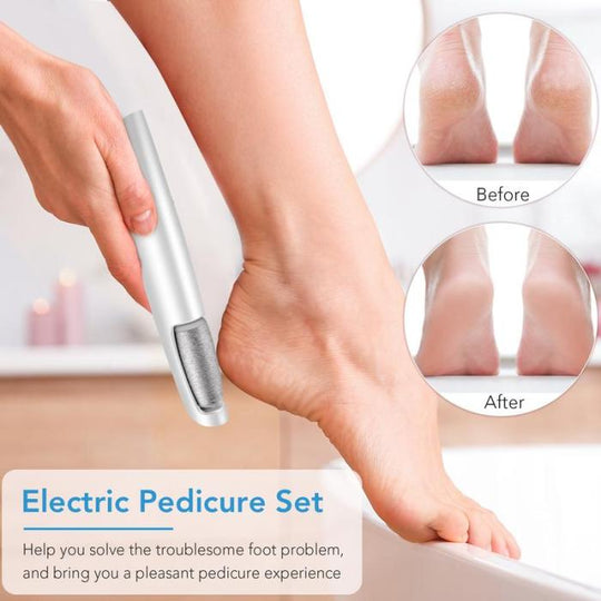 🔥Last Day Special Price £11.99!!💥🎁Portable Electric Feet Callus Remover