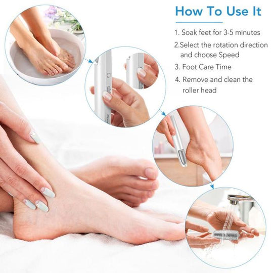 🔥Last Day Special Price £11.99!!💥🎁Portable Electric Feet Callus Remover